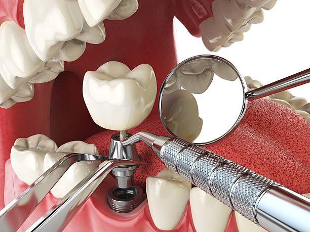 Best Emergency Treatment for Oral Infections in Hawley, MN